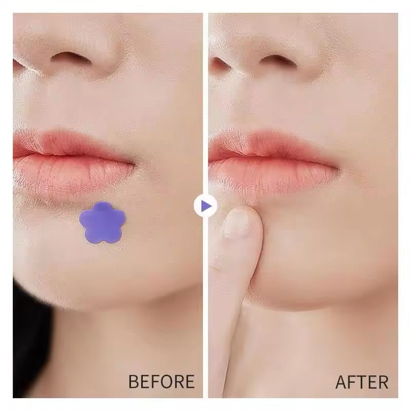 Pack 20 parches anti acné kawaii