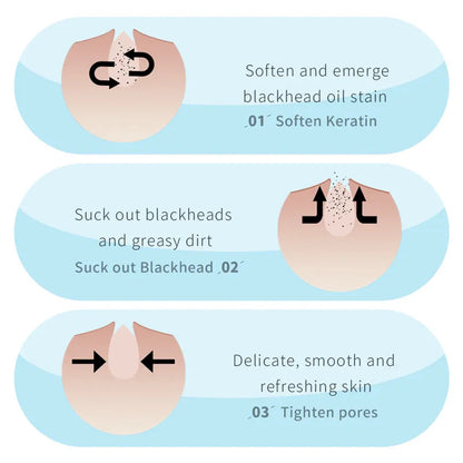 Kit 2 steps de limpieza para puntos negros