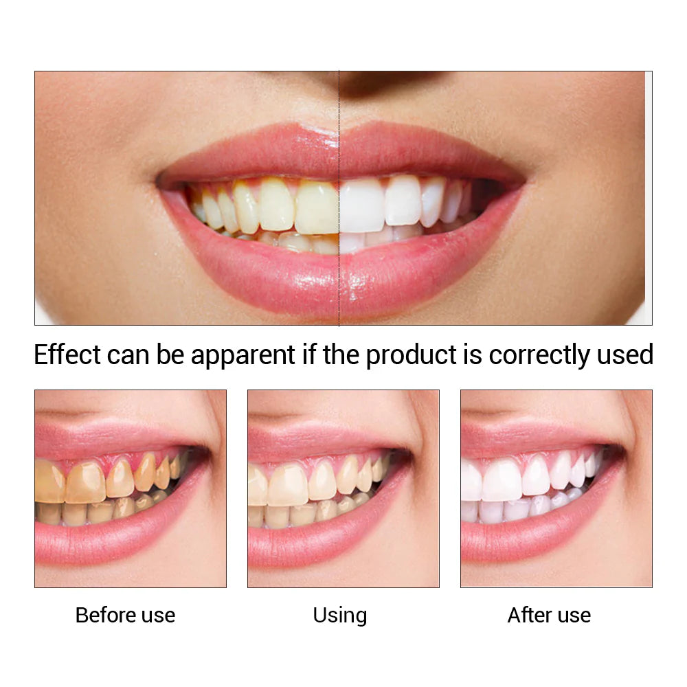 Kit esencia blanqueadora dental antimanchas